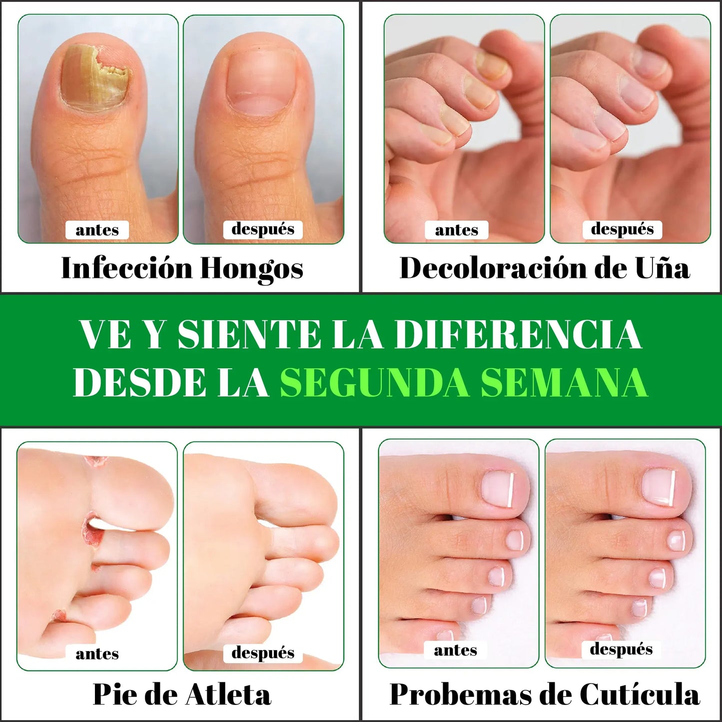 PACK ANTIMICOTICO (GOTAS DE TERBINAFINA + SYNDET ANTIMICOTICO) - L0217