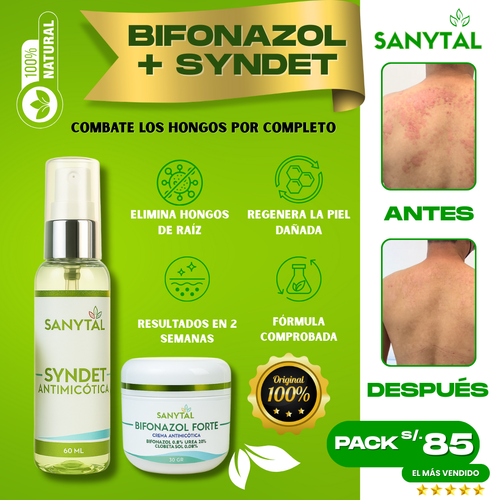 PACK ELIMINA TIÑA E INFECCIONES POR HONGO EN LA PIEL (BIFONAZOL FORTE + JABÓN ANTIMICOTICO SYNDET)