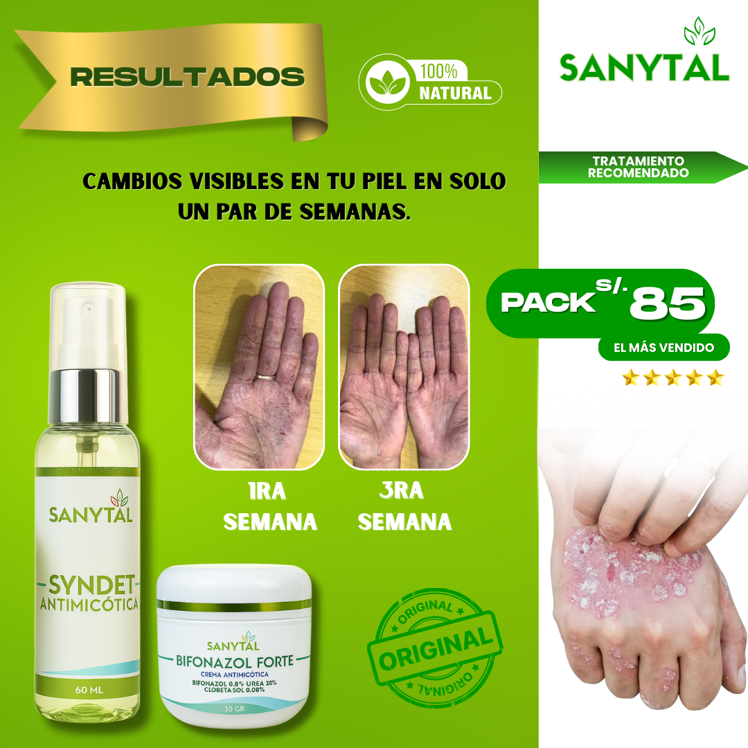 PACK ELIMINA TIÑA E INFECCIONES POR HONGO EN LA PIEL (BIFONAZOL FORTE + JABÓN ANTIMICOTICO SYNDET)