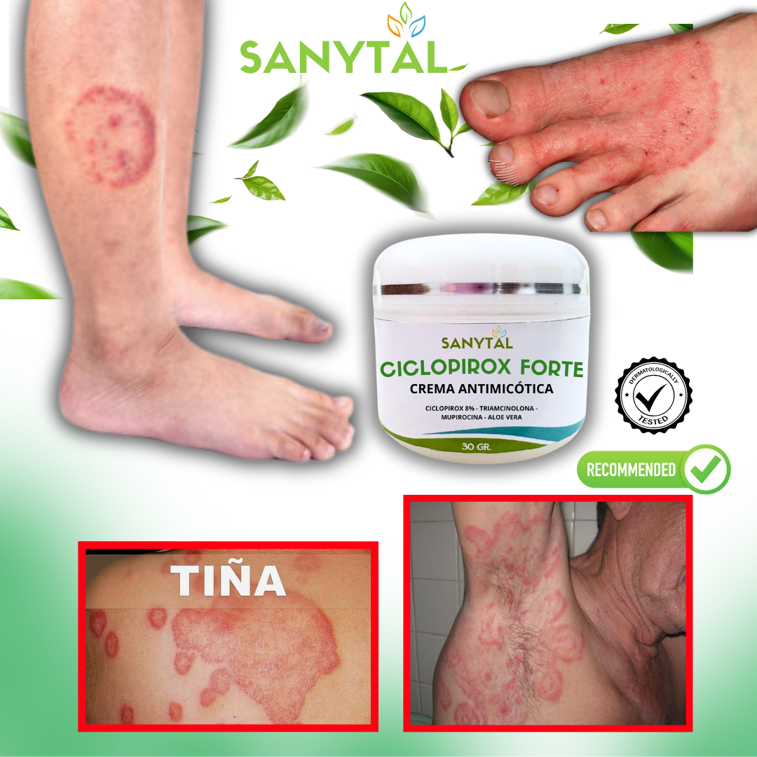 CICLOPIROX FORTE 8% - ELIMINA LA TIÑA INGUINAL- L0120