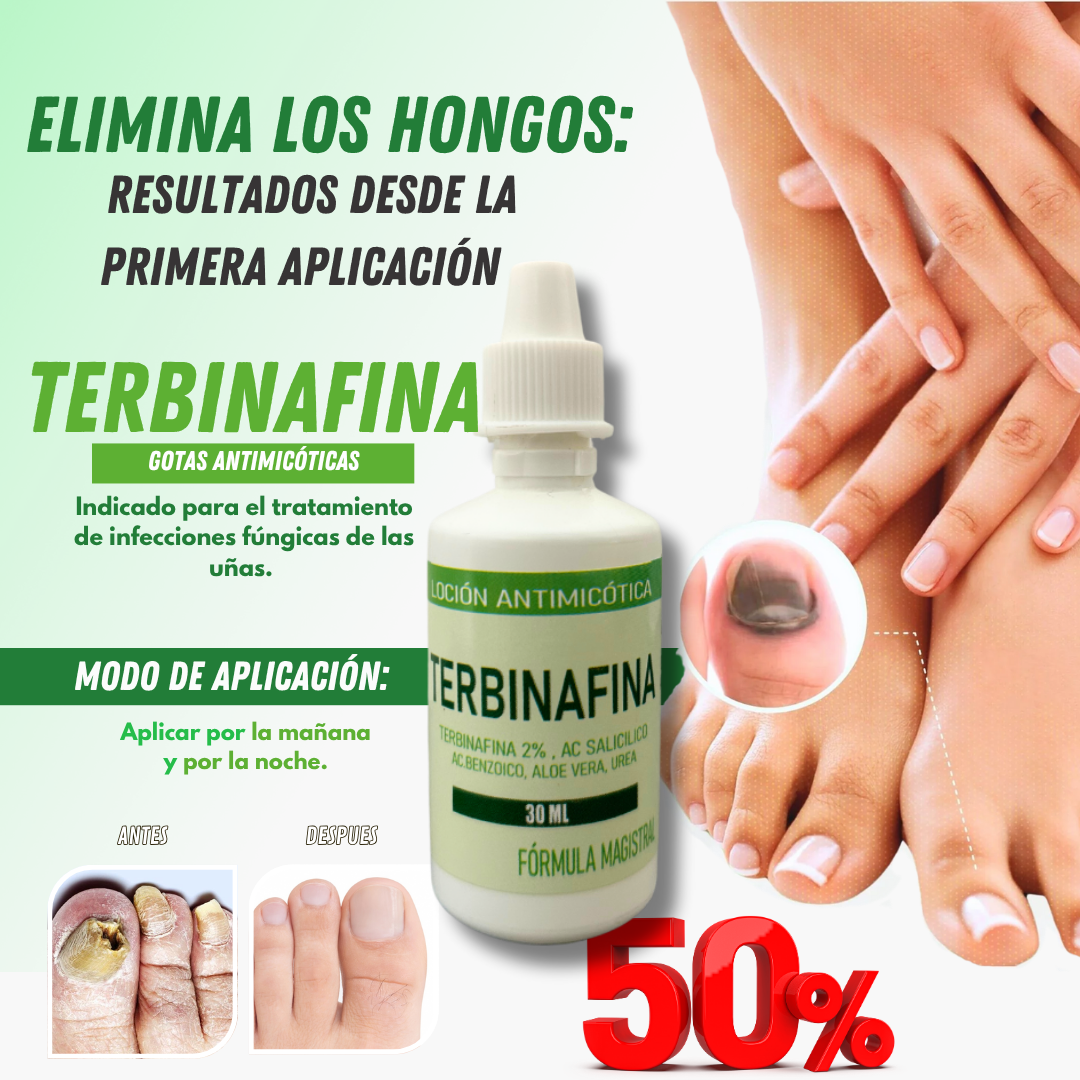 GOTAS DE TERBINAFINA PARA ELIMINAR LOS HONGOS 50 DSCTO UPSEEL. -