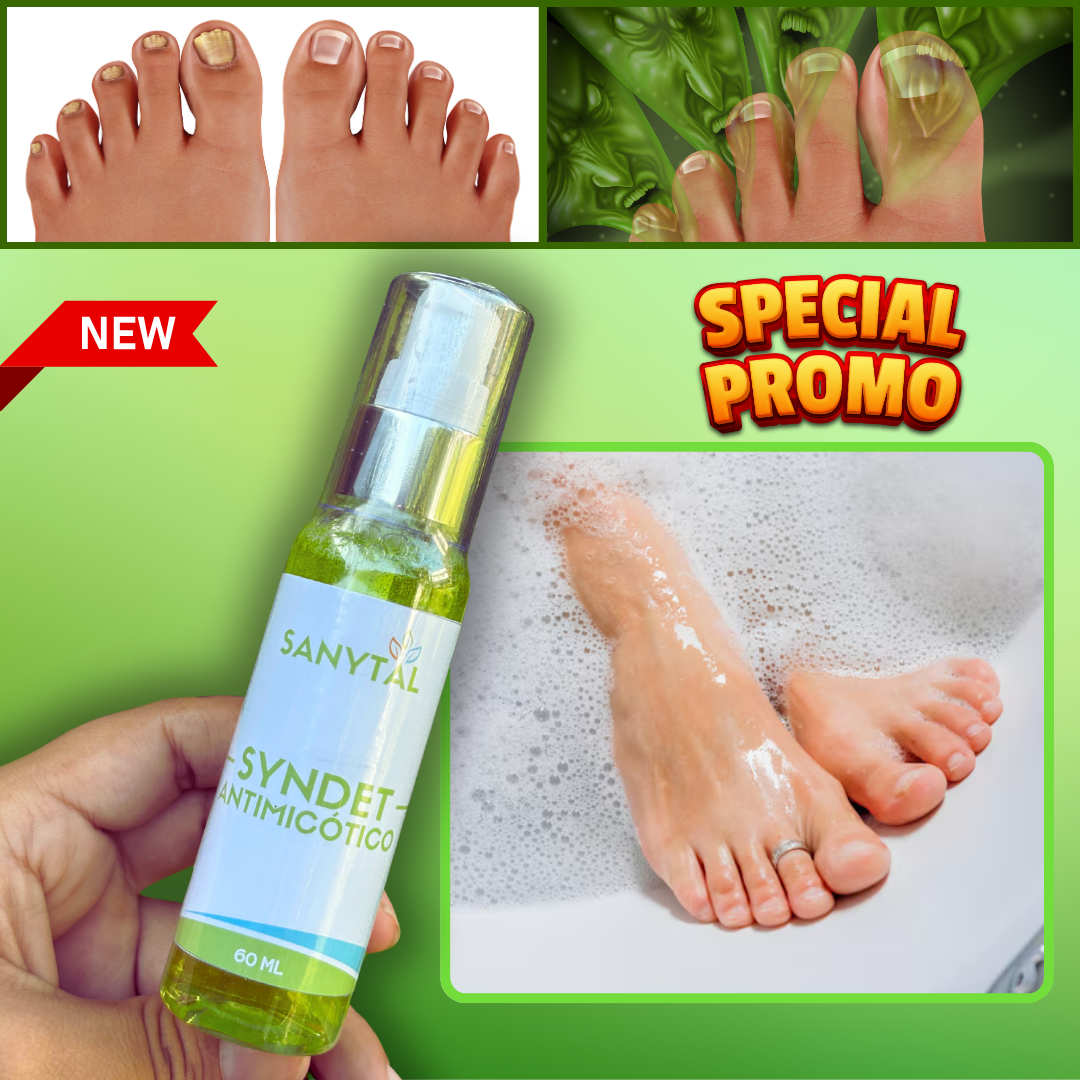 PACK ANTIMICOTICO (GOTAS DE TERBINAFINA + SYNDET ANTIMICOTICO) - L0211