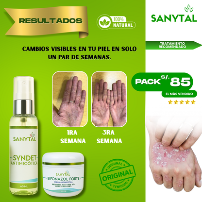 PACK ELIMINA TIÑA E INFECCIONES POR HONGO EN LA PIEL (BIFONAZOL FORTE + JABÓN ANTIMICOTICO SYNDET)