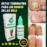 NUEVAS GOTAS DE TERBINAFINA PARA LOS HONGOS EN LAS UÑAS- L004