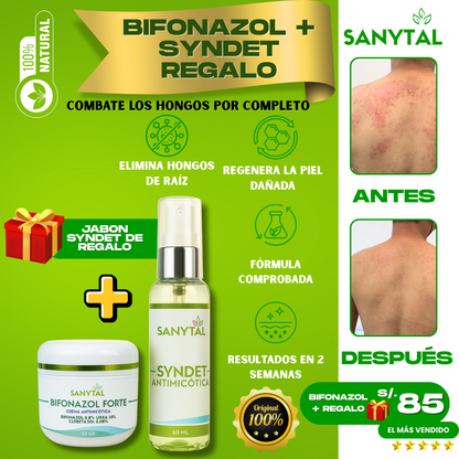 BIFONAZOL FORTE  (ELIMINA TIÑA E INFECCIONES POR HONGO EN LA PIEL)+ JABÓN ANTIMICOTICO SYNDET DE REGALO- B02