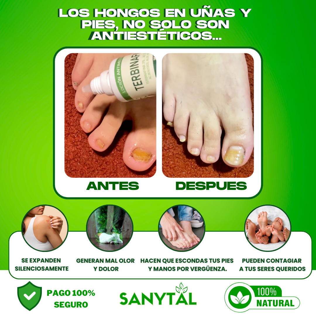 PACK ANTIMICOTICO (GOTAS DE TERBINAFINA + SYNDET ANTIMICOTICO)