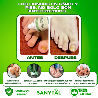 PACK ANTIMICOTICO (GOTAS DE TERBINAFINA + SYNDET ANTIMICOTICO)